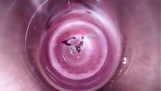 Camera gaping void inside teen creamy vagina